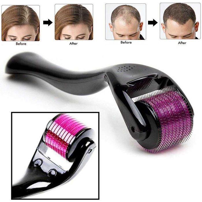 Дермаролер Derma Roller 540 голок — мікронідлінг, мезоролер 0,25–2 мм