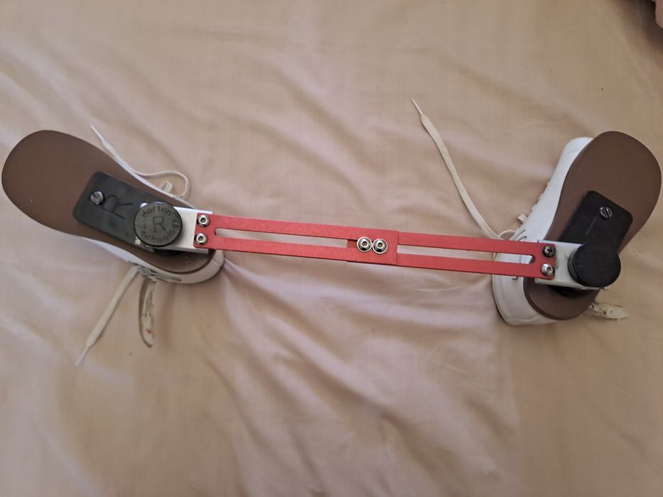 Брейси. Ортопедичне взуття для лікування клишоногості