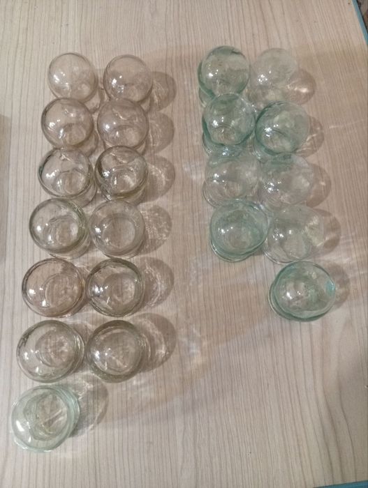 Банки вакуумні лікувальні масажні