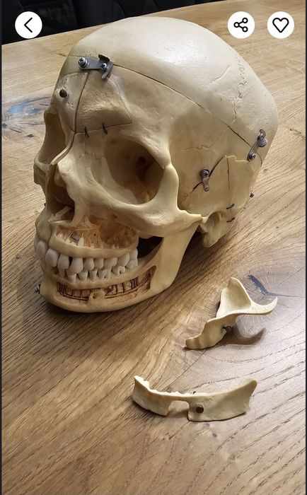 Czaszka do nauki anatomii dla stomatologów i lekarzy.