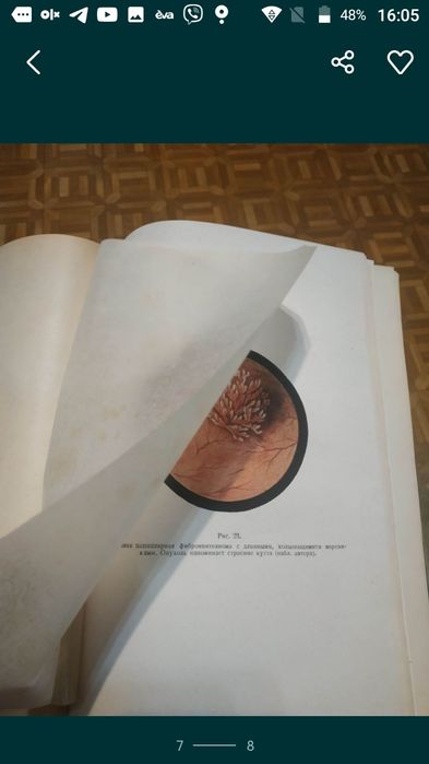 Книга 1938 г.  Опухоли  мочевого  пузыря. Шапиро
