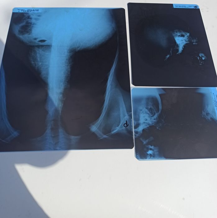 Klisze, zdjecia RTG rentgenowskie