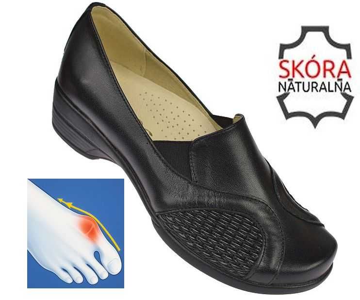 Polskie skórzane buty damskie na haluksy na koturnie 952 bk  roz. 36