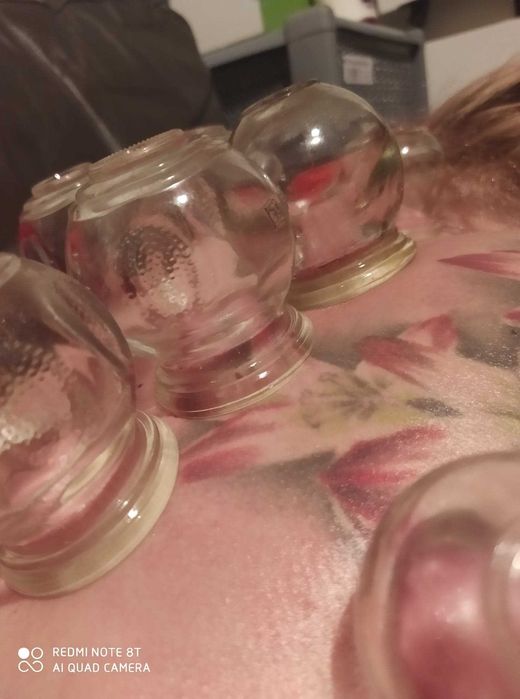 Stawianie baniek, Świecowanie uszu, Masaż olejkami,  Biorezonans.