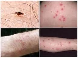 Служба знищення тарганів. клопів. блох. кліщів Уничтожение тараканов