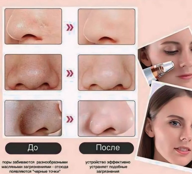 Вакуумний очисник для обличчя