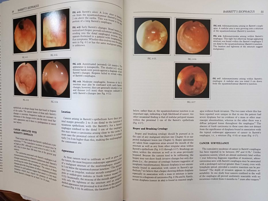 Endoscopic Interpretation (Blackstone)