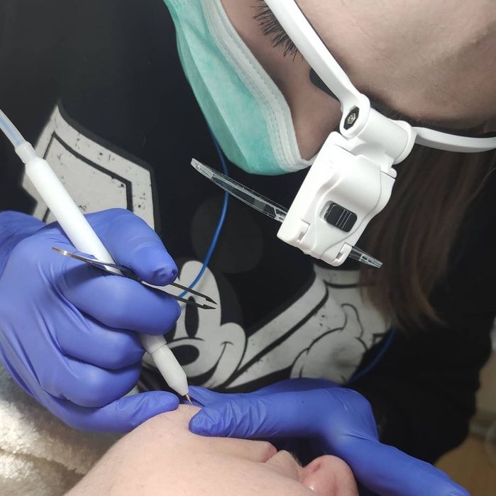 Електроепіляція та воскова депіляція. 10 років досвіду. Центр Бучі.