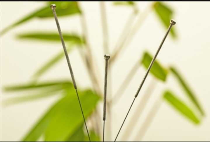 Голкорефлексотерапевт, невролог дитячий, дорослий  Новомосковськ