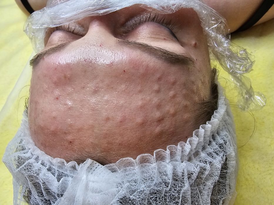 Косметолог (ботокс, контурная пластика губ,мезо, біоревіталізація)