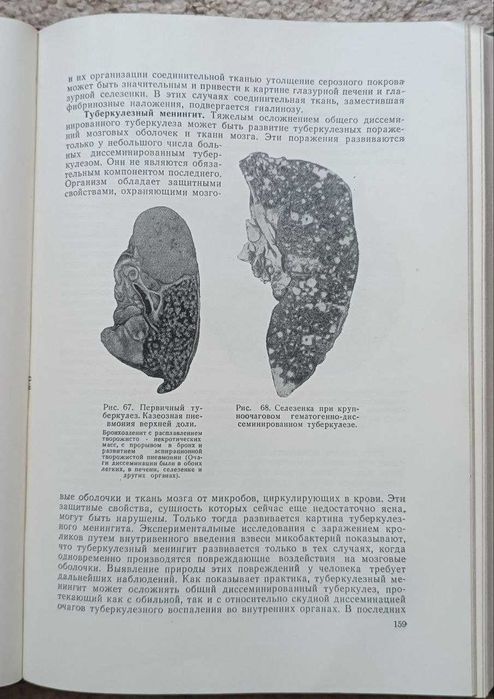 Підручник "Патологическая анатомия"