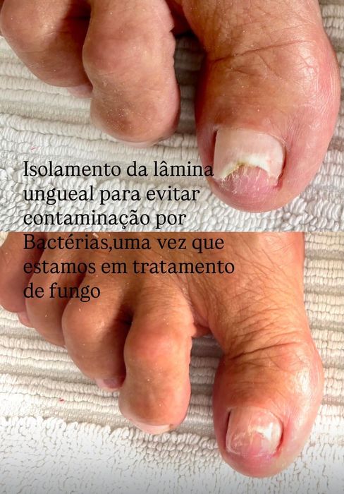 Podóloga cuidado e saúde dos pés