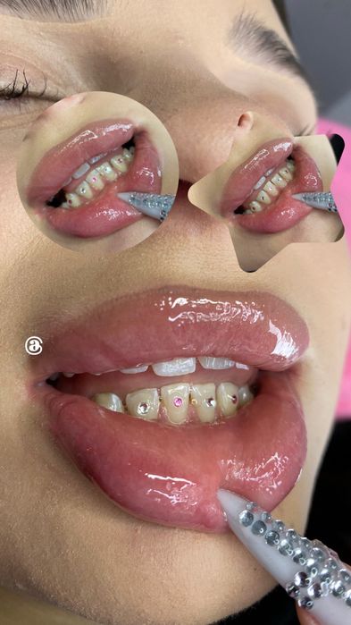 Toothgems dla pań/panów