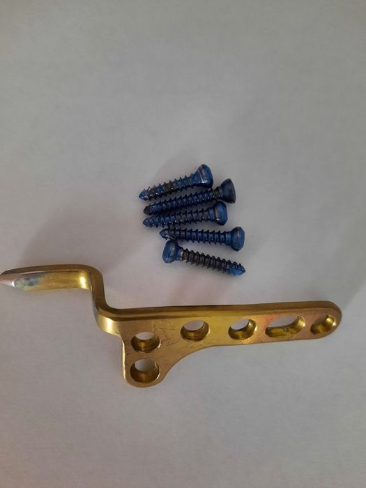 Титановая пластина на правую ключицу