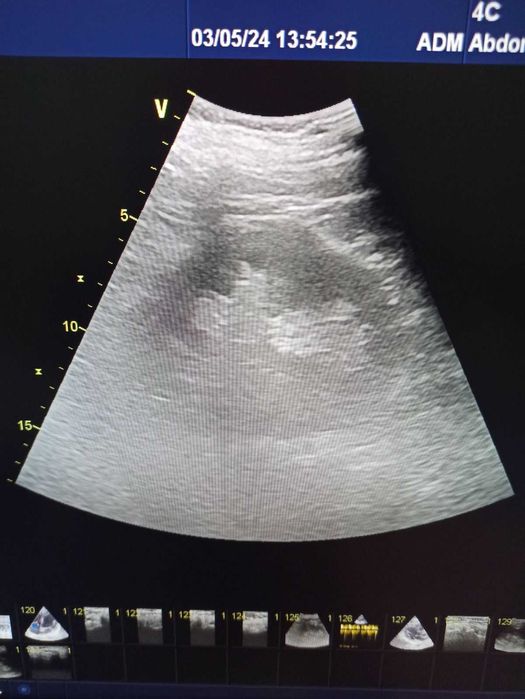 Експертна кардіосистема GE Vivid E9 (2016) M5S-D, 11L-D, 4C-D