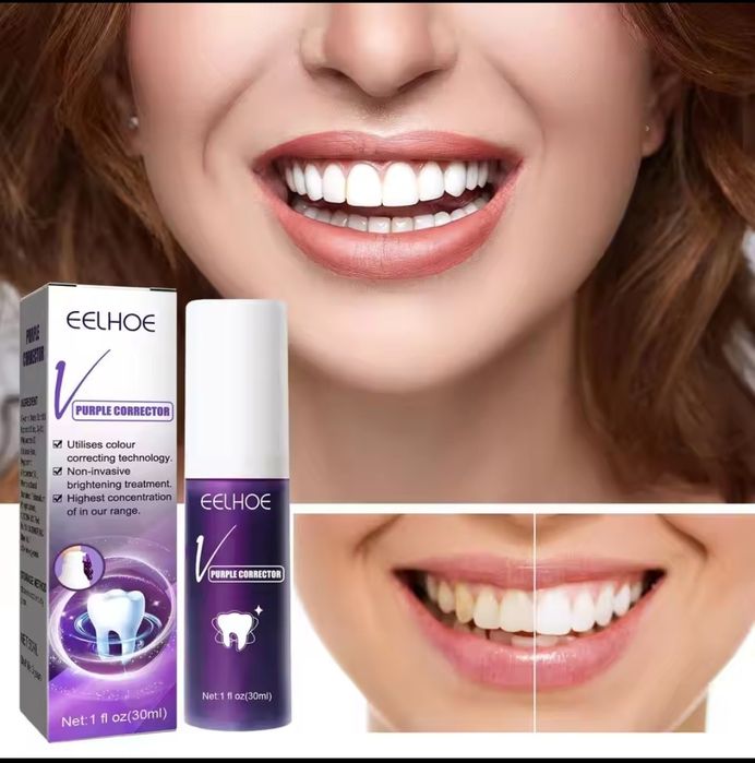 Branqueamento dental