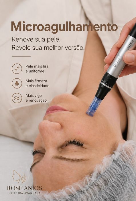 Hifu, microagulhamento, Microblading,