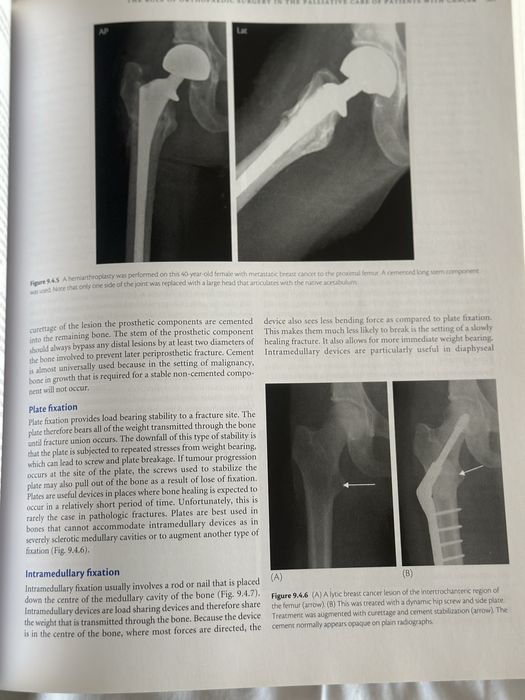 Oxford Textbook of Palliative Medicine