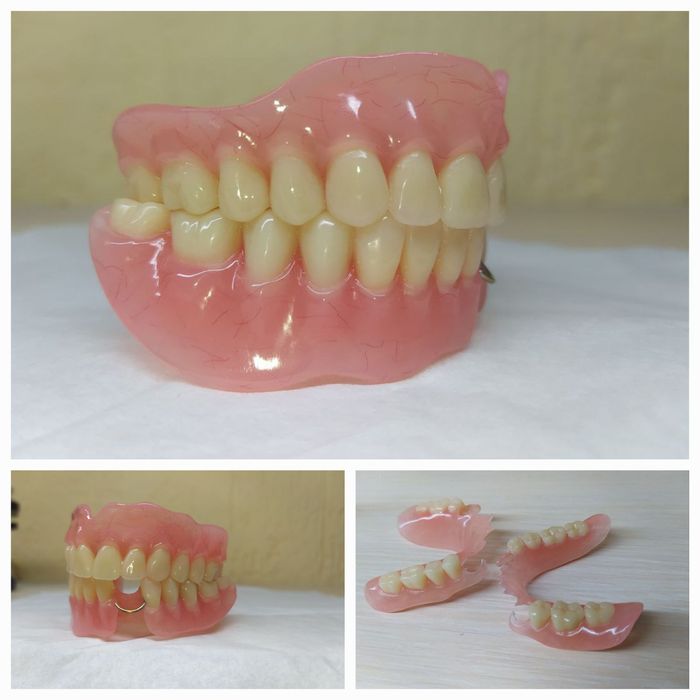 Зубний технік!Співпраця зі стоматологом