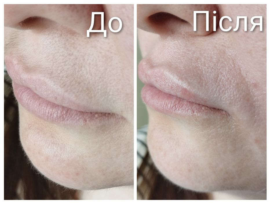 Воскова депіляція