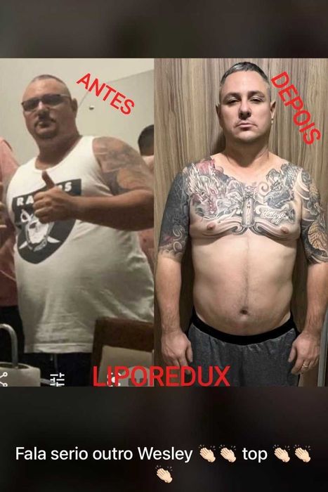 LIPOREDUX emagrecedor
