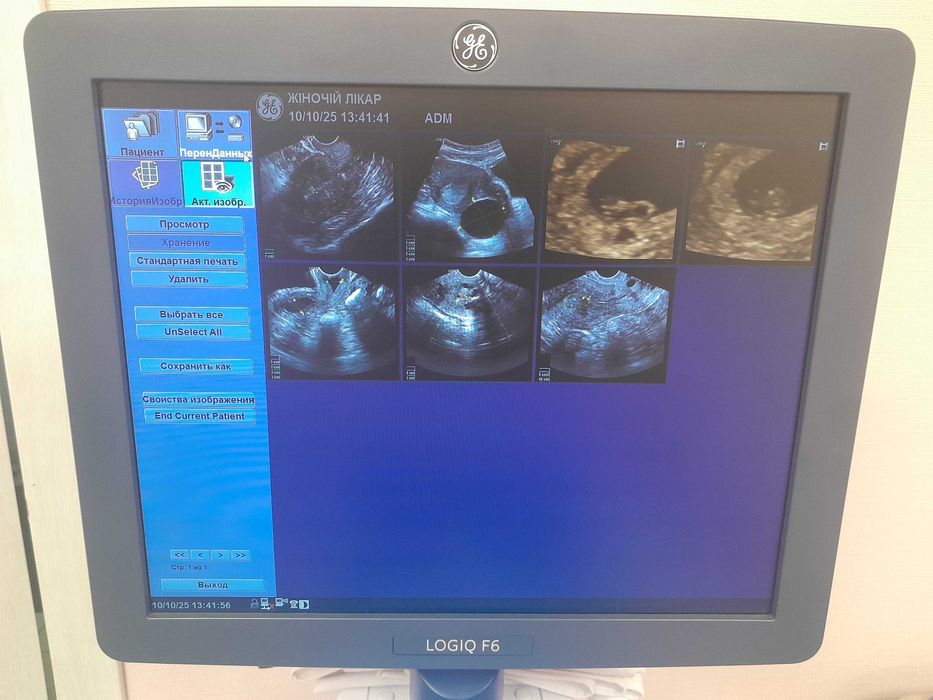 Продам УЗД апарат GE Logiq F6