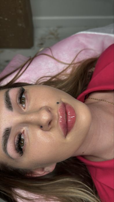 Powiększanie Ust 550 zł Russian Lips  BOTOX 500 zł