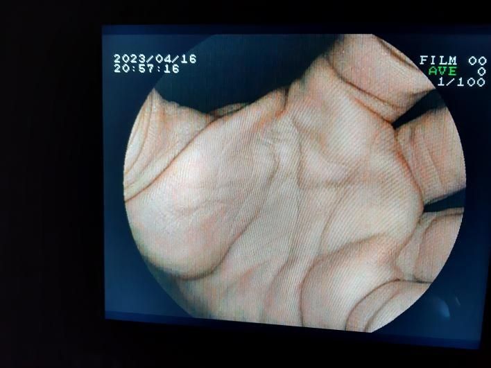 Ендоскоп. Відеогастроскоп. Відеопроцесор. Клавіатура.