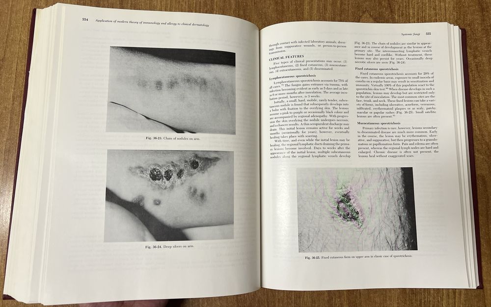 “Dermatologic Immunology and Allergy” edited by Julius Stone