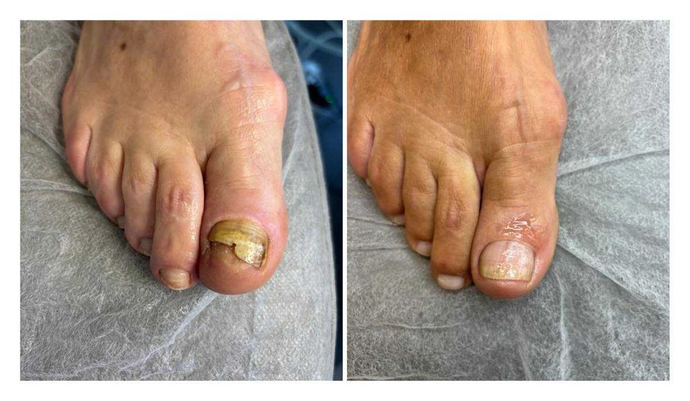 Mobilny podolog Sosnowiec | podolog z dojazdem