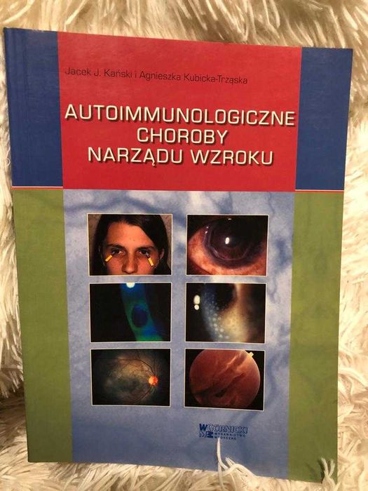 Autoimmunologiczne choroby narządu wzroku Kański Kubicka-Trząska