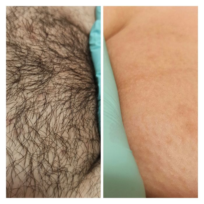 Масаж Шугаринг  Мукачево