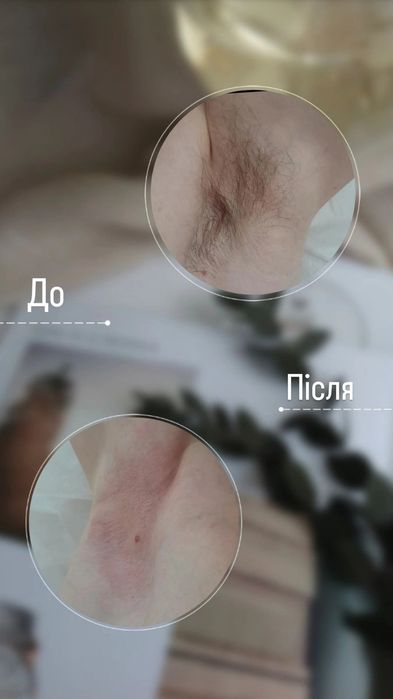 Воскова депіляція