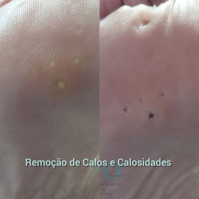 Pedy Clean, estética e cuidados específicos dos pés