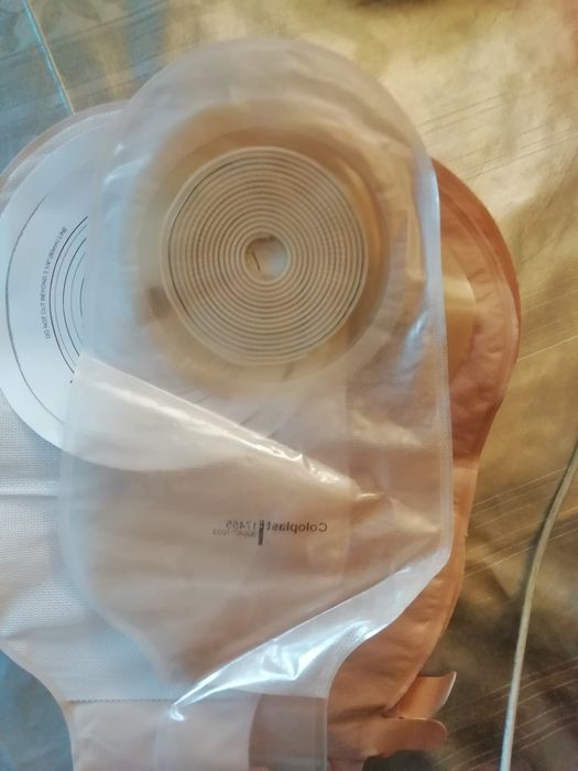 Калоприемник. Стома