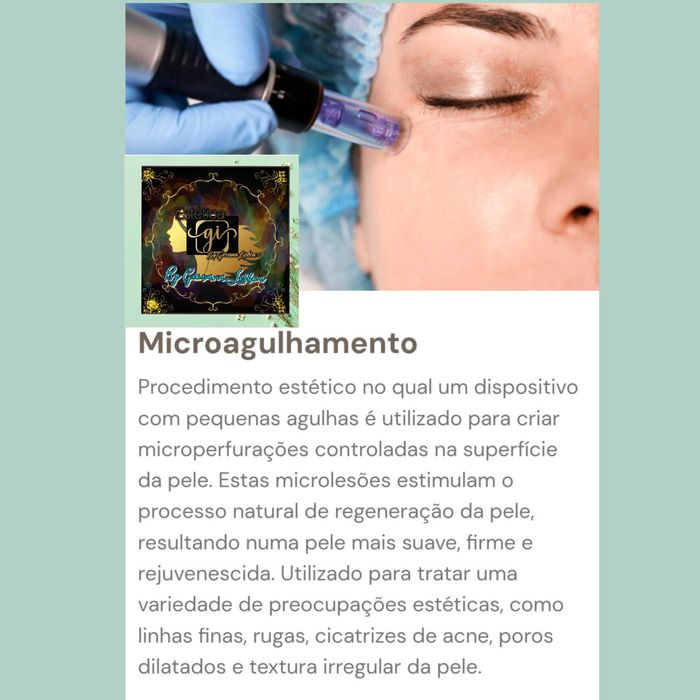 Maderoterapia na  Pontinha, dermapen,blooming skin