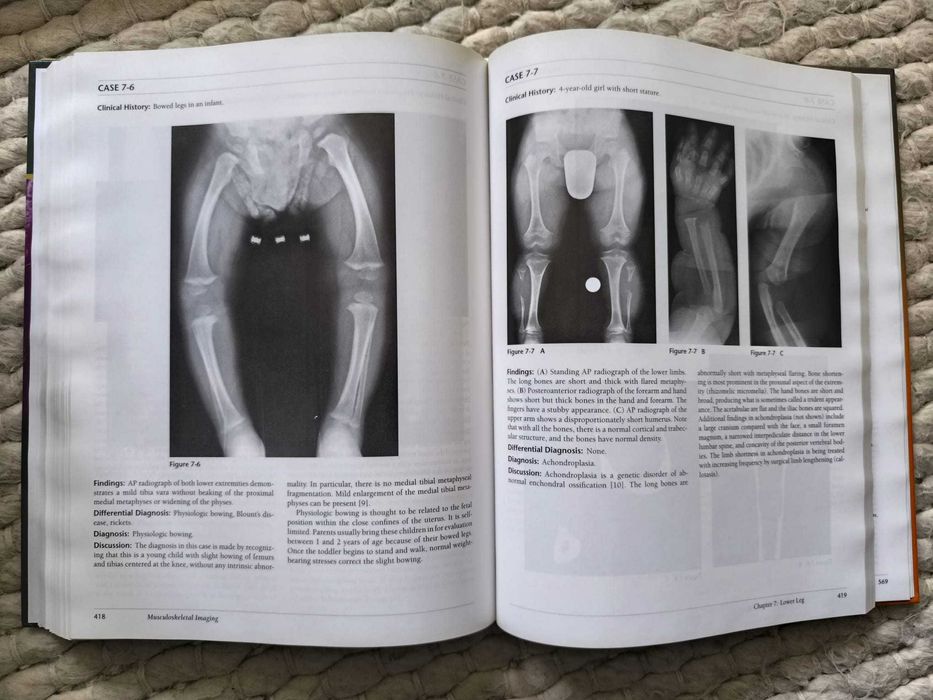 Livro "Musculoskeletal Imaging: A Teaching File" de Felix Chew