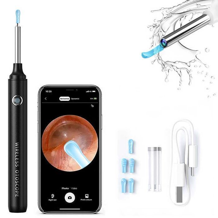 Smart Otoskop Kamera Czyszczenie Uszu Wosk Wifi HD