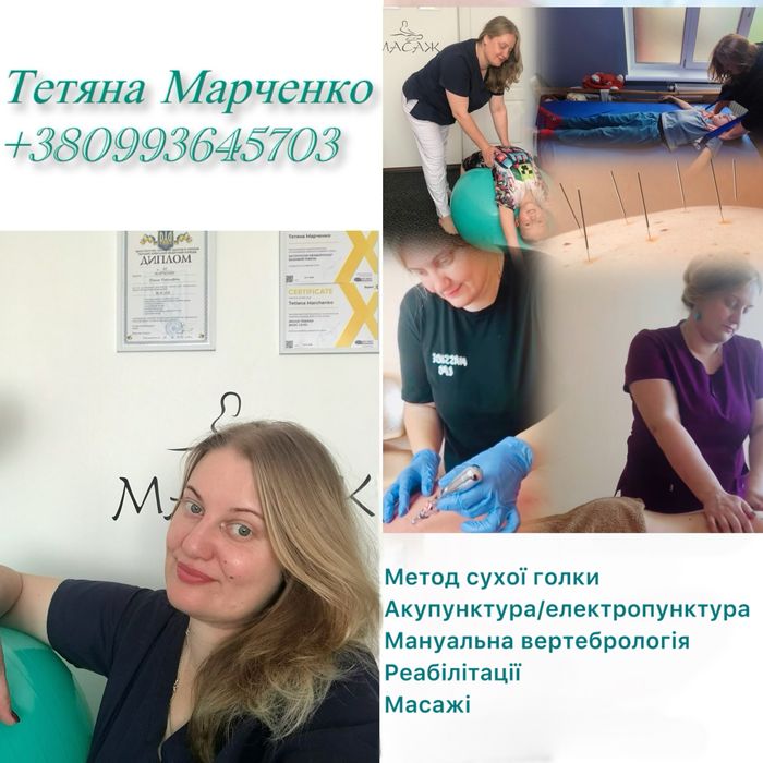 Масаж,мануальна вертебрологія,реабілітація,метод сухої голки м.Сміла