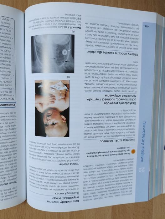 Pediatria Tom Lissauer Will Carroll