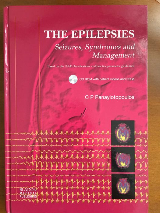 The Epilepsies: Seizures, Syndromes and Management