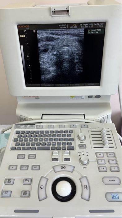 Samsung Medison SonoAce Pico узи апарат