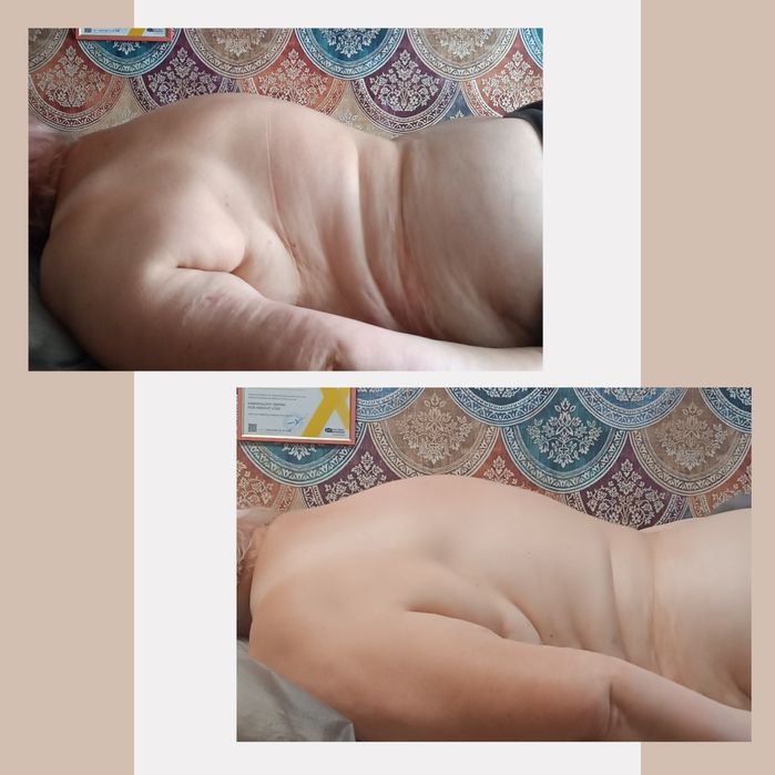 Лікувально-оздоровчий масаж. Реабілітаційний масаж. Кінезіотейпування