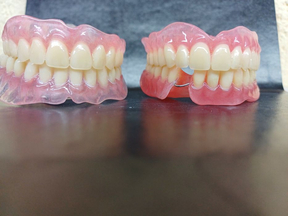 Зубний технік!Співпраця зі стоматологом