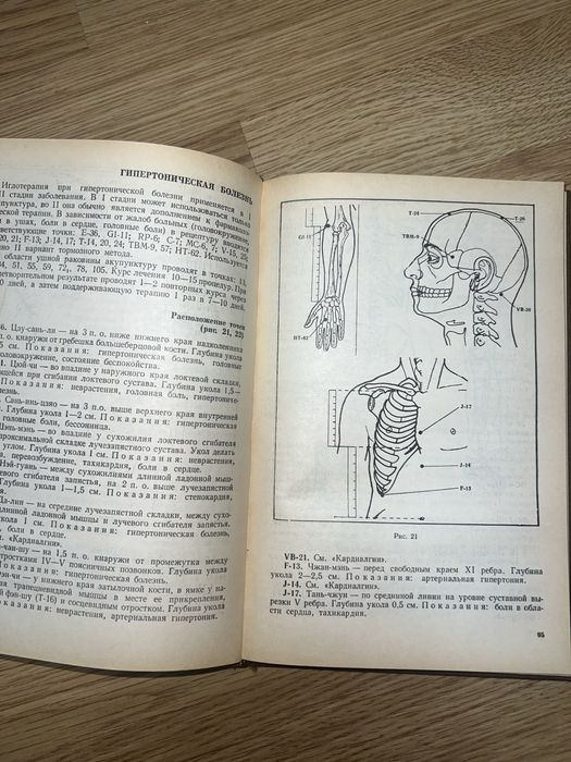 Поактическое руководсиво по иглорефлексотерапии.  Н.Н. Громов, 1983