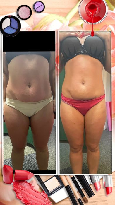 ПрофесійнийМасажОбгортуванняSTYXРусанівка,Березняки,Лівобережна,Черніг