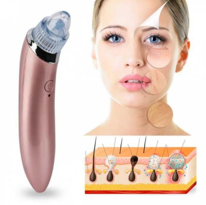 Вакуумний апарат для чищення обличчя Beauty Skin Care Specialist XN-80