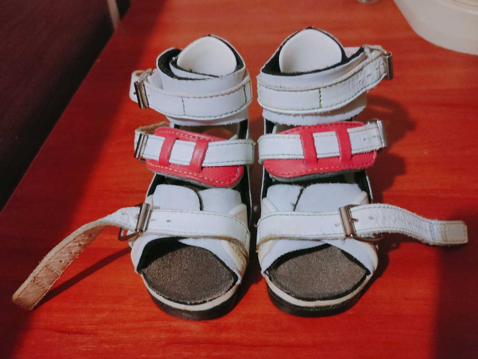 Брейсы для лечения косолапости