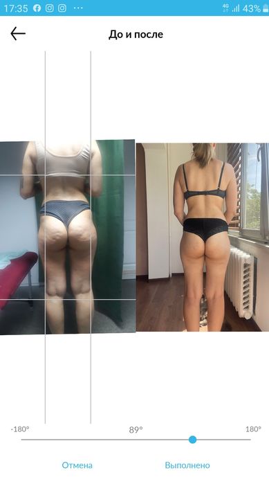 ПрофесійнийМасажОбгортуванняSTYXРусанівка,Березняки,Лівобережна,Черніг