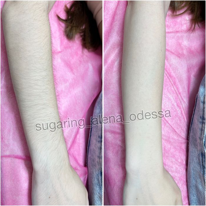 Шугаринг Воск Центр